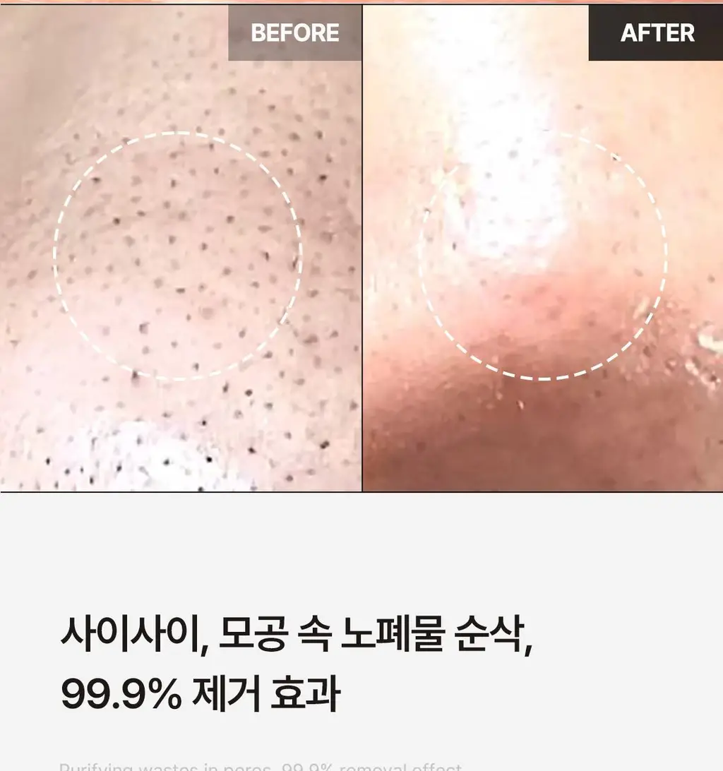 [피지순삭/요철삭제] 에이프릴스킨 당근클렌징밤 90ml 기획 (+미니밤 2개 증정) 상세페이지 31